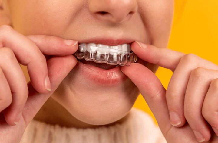 ¿Cuáles son los beneficios para la salud de los tratamientos de ortodoncia?