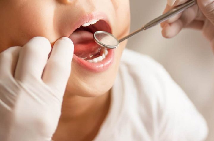 Hábitos negativos que pueden poner en riesgo la salud dental de los más pequeños