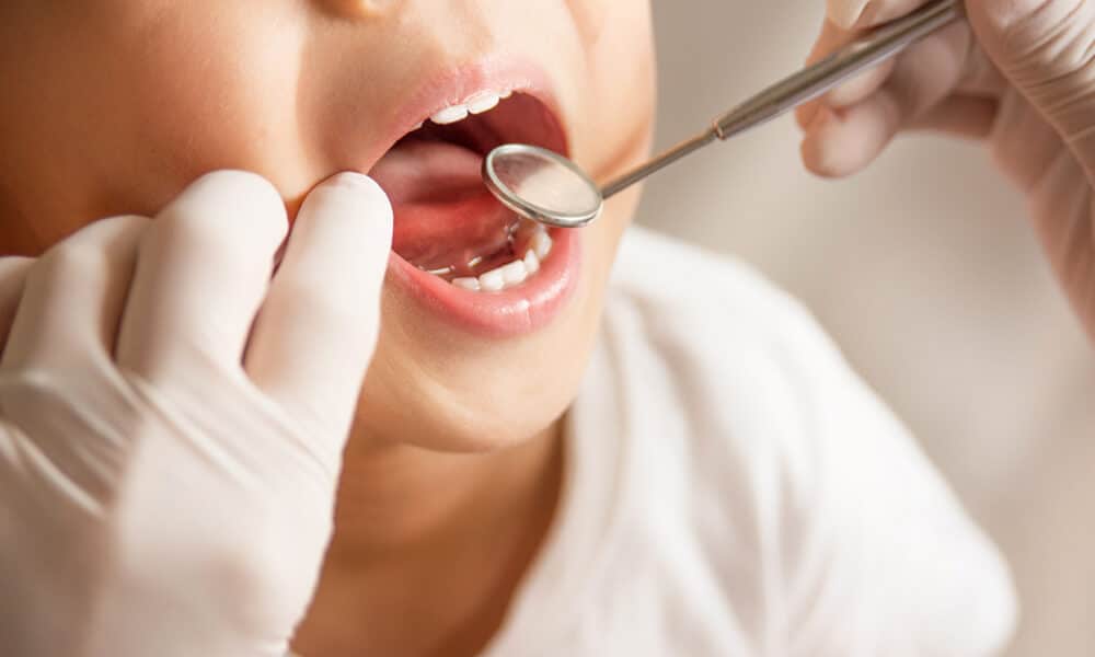 Hábitos negativos que pueden poner en riesgo la salud dental de los más pequeños