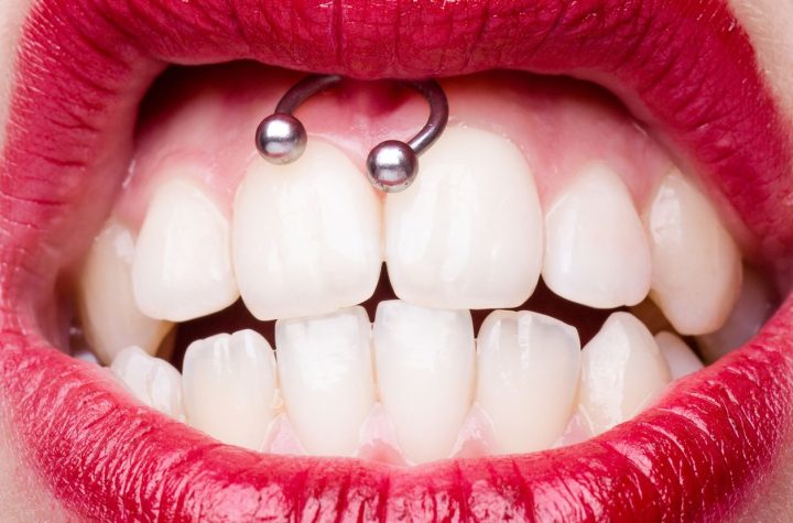 El piercing Smiley: ¿duele realmente tanto como dicen?