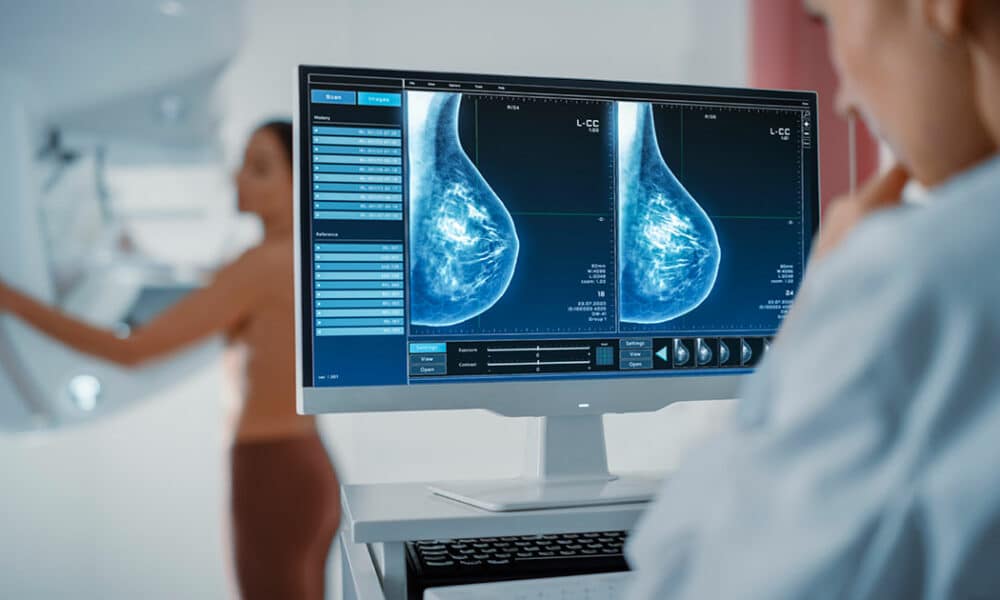 Los avances tecnológicos evolucionan los tratamientos radioterápicos en el cáncer de mama