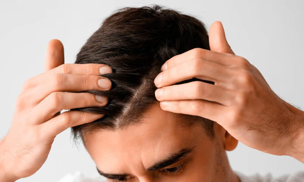 Mejor clinica de injerto capilar para la alopecia