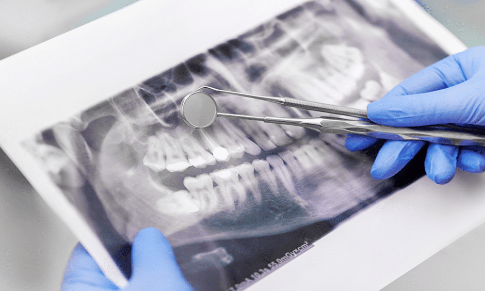 Descubren relación entre el Microbioma oral y la Salud Mental