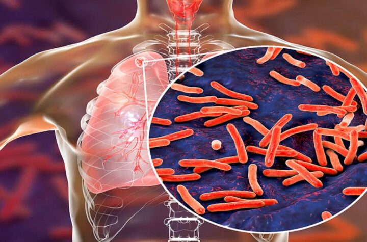 La vacuna española de la tuberculosis hace historia y entra en Fase 3