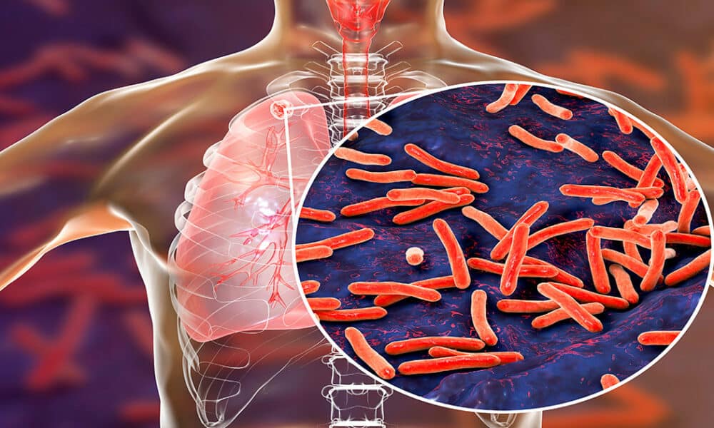 La vacuna española de la tuberculosis hace historia y entra en Fase 3