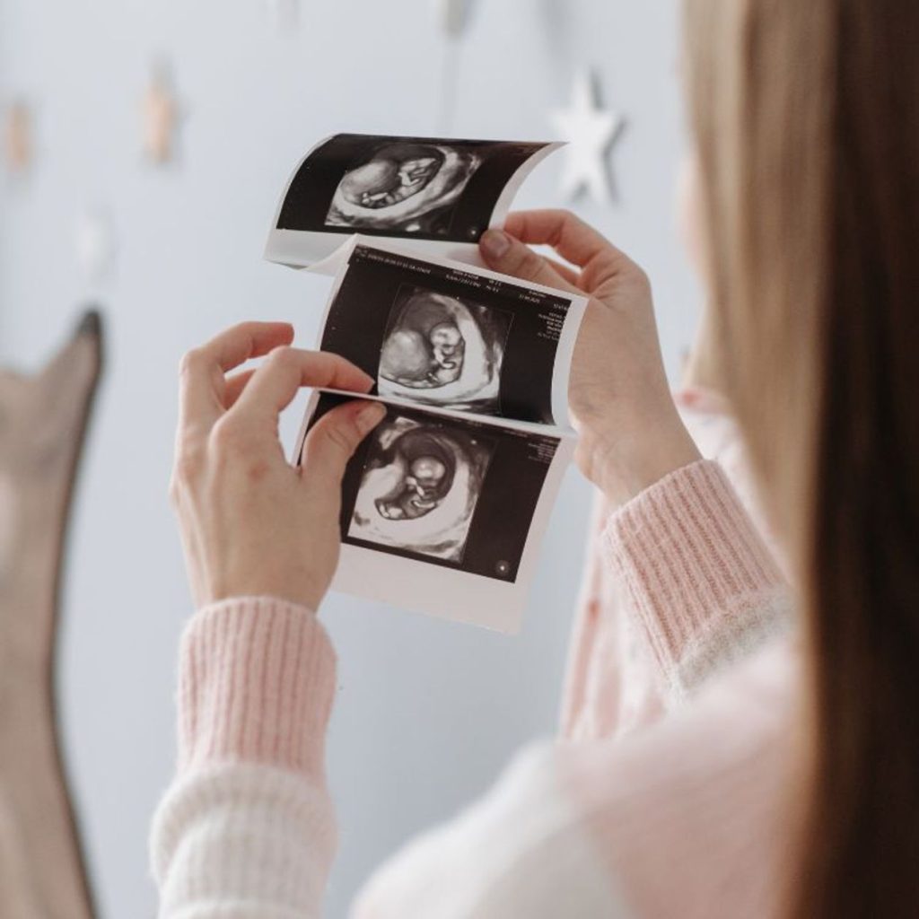 Nuevos métodos científicos para predecir resultados de embarazos con problemas de crecimiento fetal