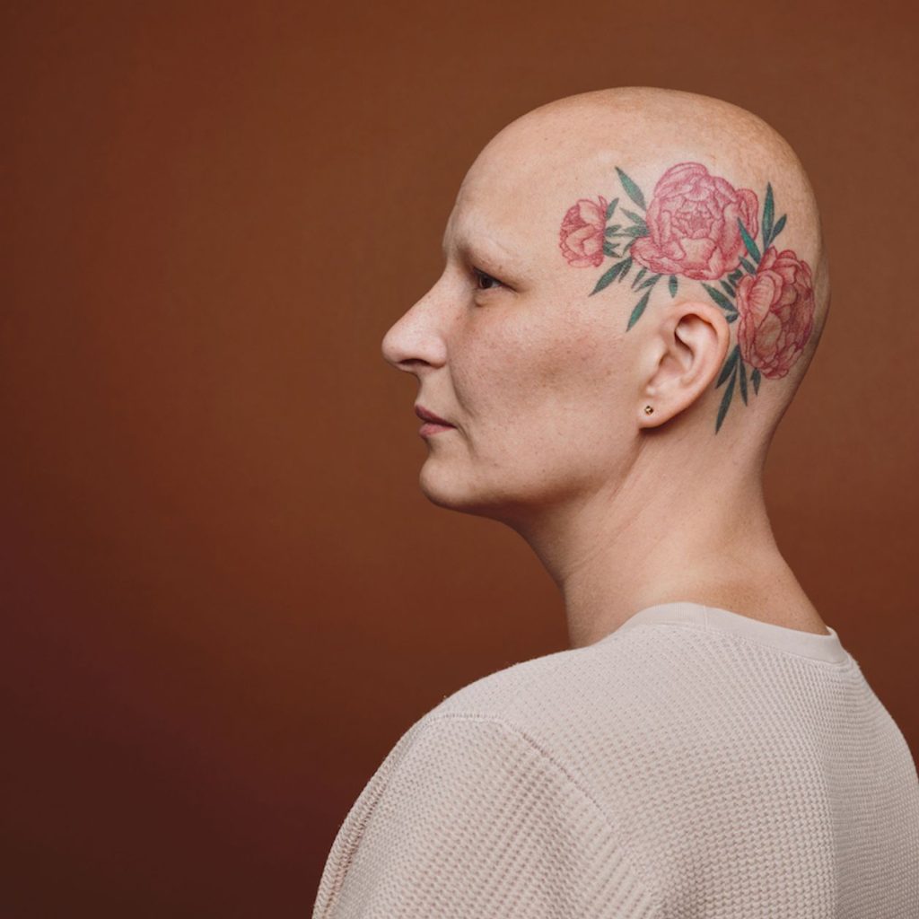 ‘Calvas: mujeres sin nada que ocultar’, libro y exposición que desafían el estigma de la alopecia femenina