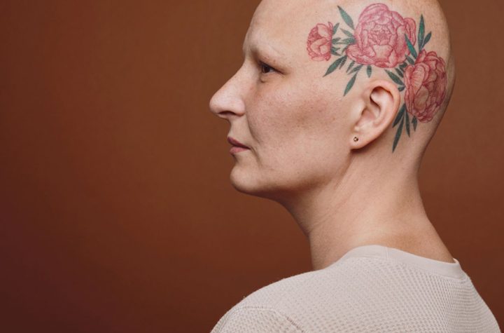 ‘Calvas: mujeres sin nada que ocultar’, libro y exposición que desafían el estigma de la alopecia femenina