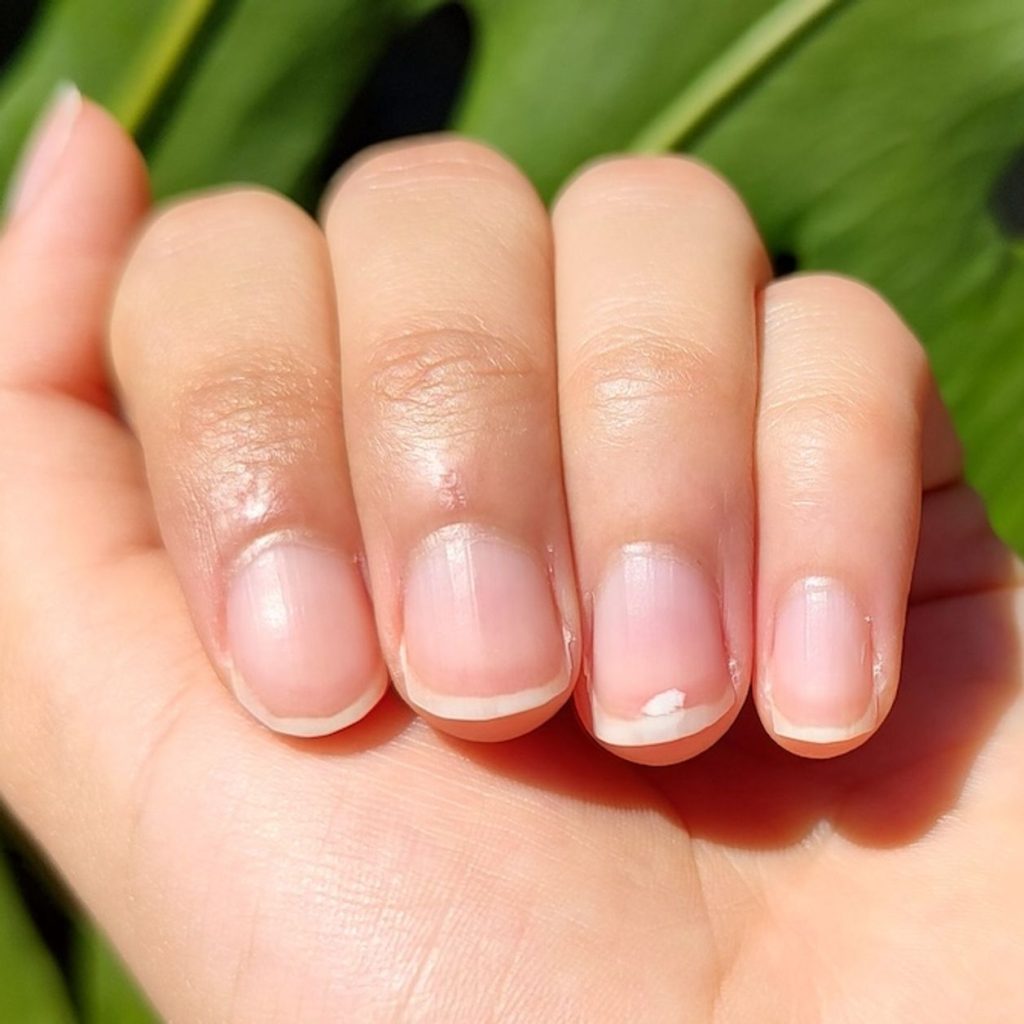 Manchas blancas en las uñas: ¿Mito del calcio o señal de alerta?  ¡Farmacéutico te lo explica!