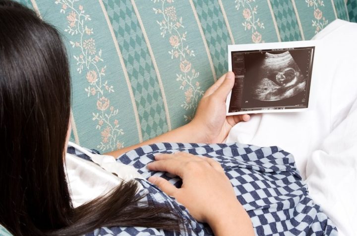 ¡Bebé de piedra!  Fallece mujer tras 30 años con un feto calcificado en su vientre