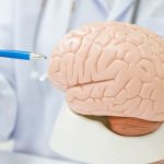 TRATAmiento de la Hidrocefalia del Adulto en Madrid: Diagnóstico y opcionares Con Expertos en neurocirugía