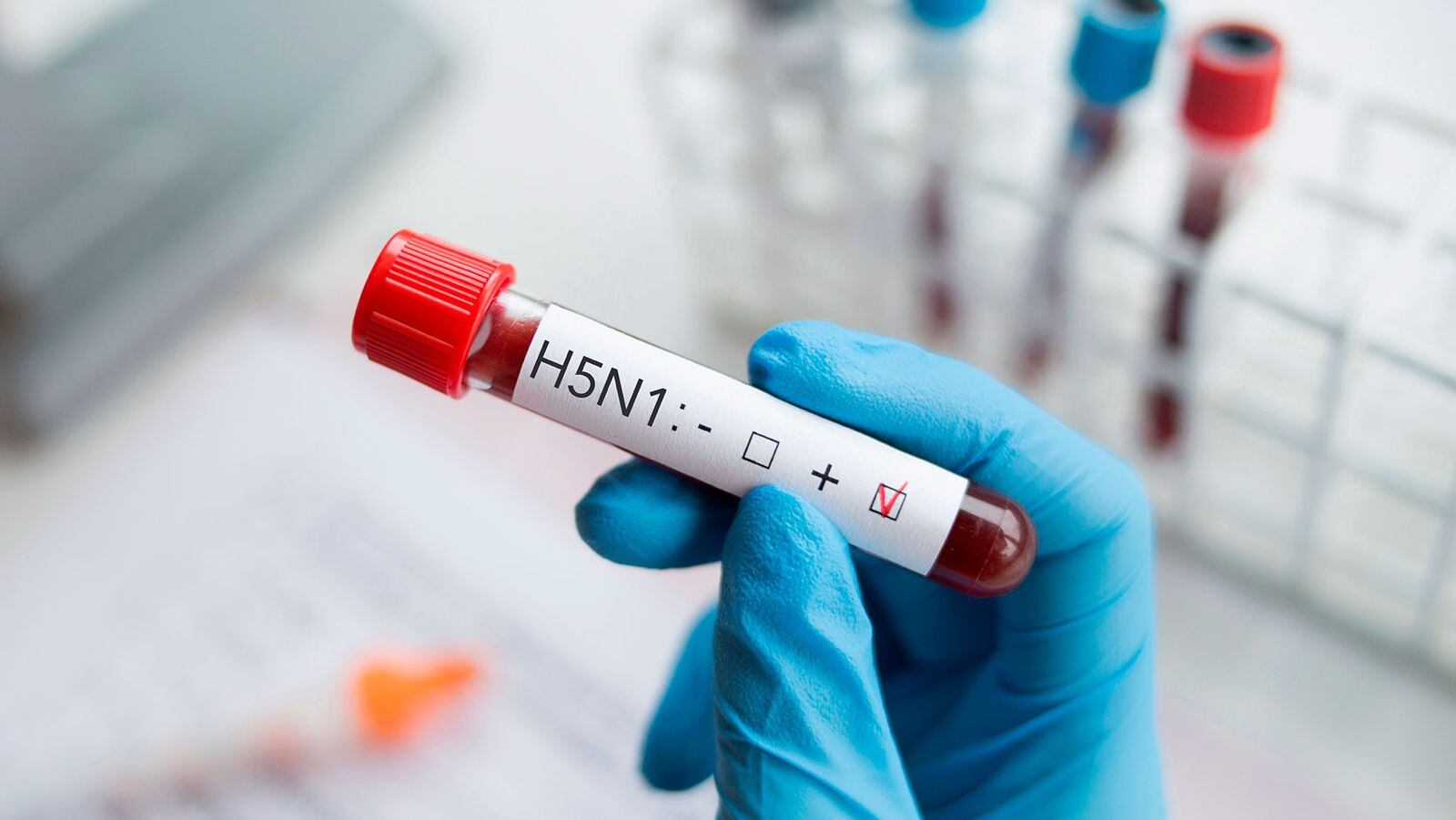 Secretaría de Salud confirma el primer caso de influenza aviar H5N1 en una persona en México